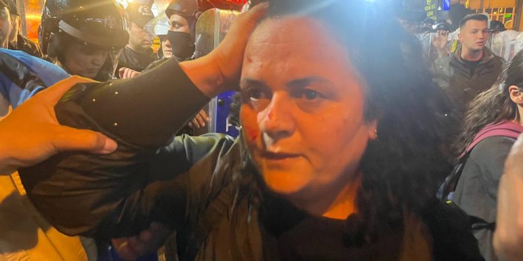 Önder APO’ya Özgürlük Yürüyüşüne Giden Gençlere Polis Saldırısı