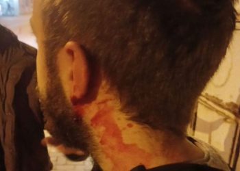 Bartın’da Üniversite Öğrencilerine Faşist Saldırı