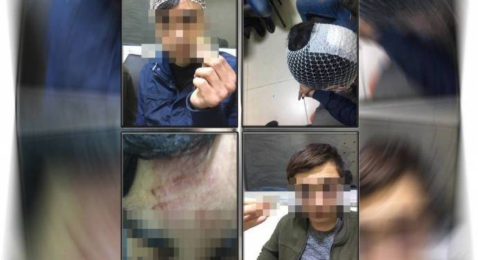 İşgalci Emniyet, belgelerle kanıtlanan işkenceyi inkar etti