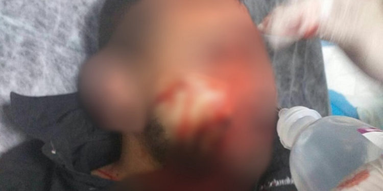 Ezaz’daki eylemde 3 özel harekat polisi yaralandı