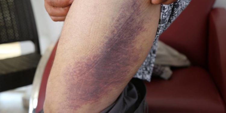 Xalfetî’de gözaltına alındı: Riha TEM’deki işgalci Türk polislerin vahşetini anlattı