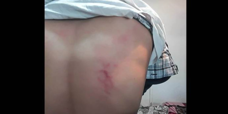 İşgalci polisler yurttaşlara saldırdı: 8 yurttaş gözaltına alındı