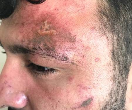 İşgalci Türk polisi şehit ailesine saldırdı!