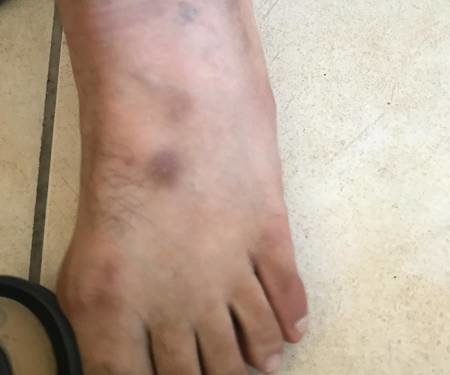 İşgalci Türk polisi şehit ailesine saldırdı!