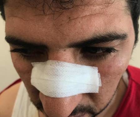 İşgalci Türk polisi şehit ailesine saldırdı!