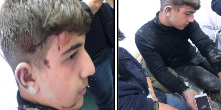 Bazîd’de ehliyetsiz çocuklara ateş açıldı, zırhlı araç çarptı, silah dipçikleri vuruldu