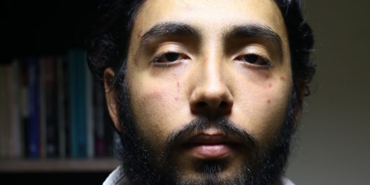 Üniversite öğrencisine faşist saldırı