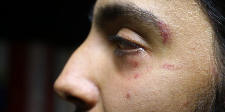 Üniversite öğrencisine faşist saldırı