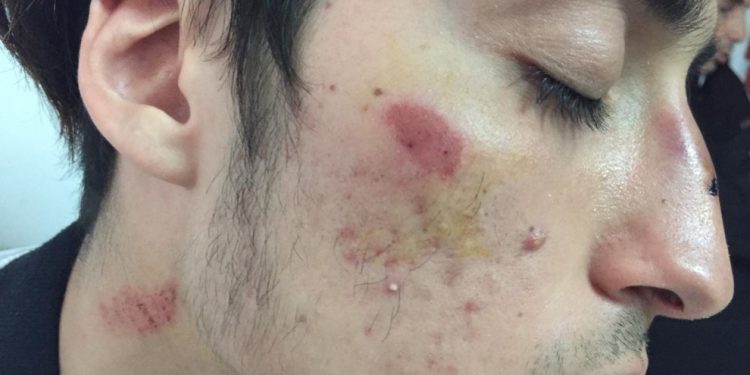 ‘Kürt öğrencilere yönelik saldırılar bir devlet politikası’