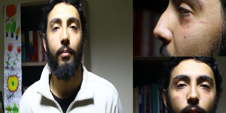 Üniversite öğrencisine faşist saldırı