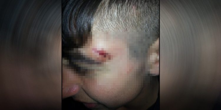 Yaşadıklarını anlatan çocuk, 2. kez işgalci Türk polislerince darp edildi