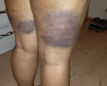 Gazi Mahallesi Karakolu’nda iki gence işkence!