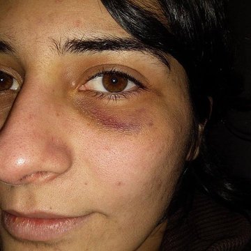 Gazi Mahallesi Karakolu’nda iki gence işkence!