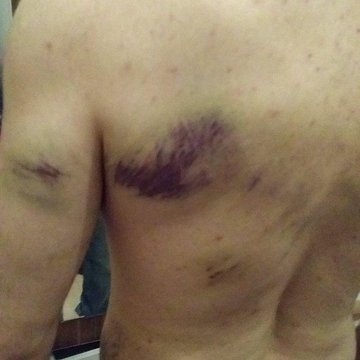 Gazi Mahallesi Karakolu’nda iki gence işkence!