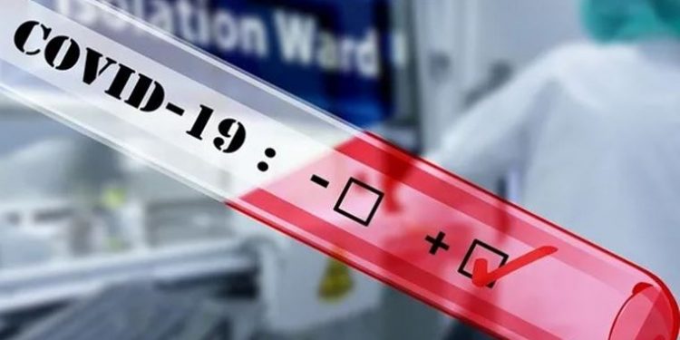 Türkiye’de ölü sayısı 30’a çıktı