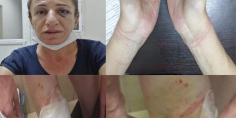 İşkence gören Rojbin’in gözaltı süresi yine uzatıldı