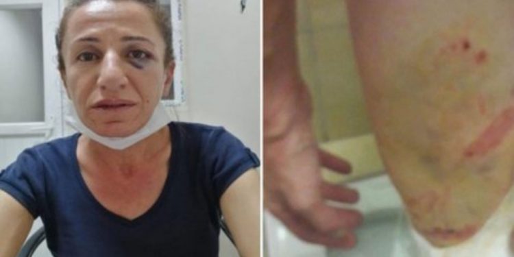 İşkence gören Rojbin tutuklandı!