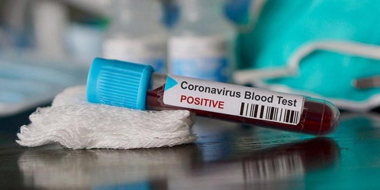 İşgalci memurlar Kürdistan’da Koronavirüsün yayılmasını mı istiyor