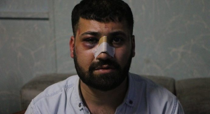 Polis işkencesi bitmiyor; Kürt kimliğinden dolayı işkence yapılıyor