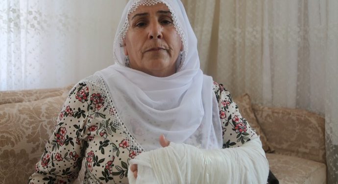 Faşist polislerin şiddeti sonucu 3 dişi ve kolu kırılan anne: Şikayetçiyim!