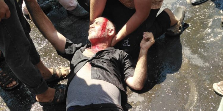 Faşist TC askeri direnişteki çiftçilere saldırdı; 2 kişi yaralandı, 7 kişi rehin alındı