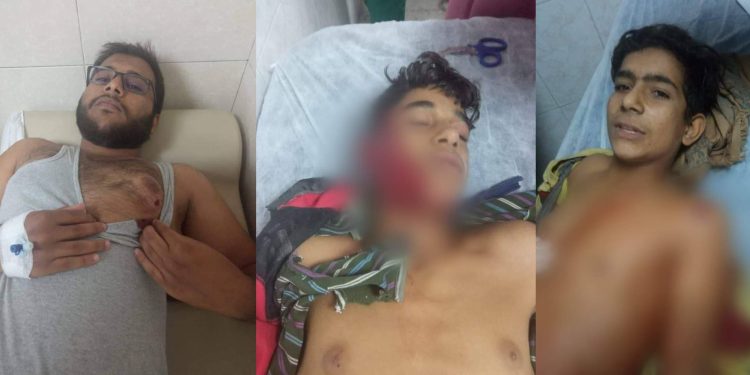 İşgalci TC ve çetelerinin vahşi saldırıları devam ediyor – 3 sivil yaralandı