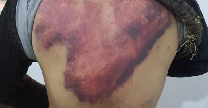 Faşist Türk askerinin Rojavalı Arap gence yaptığı işkence