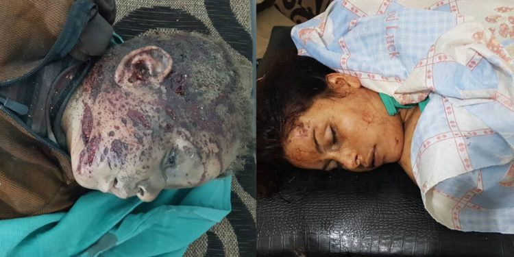 İşgalci TC katliamlarına devam ediyor – 1 çocuk ve 1 kadın yaşamını yitirdi