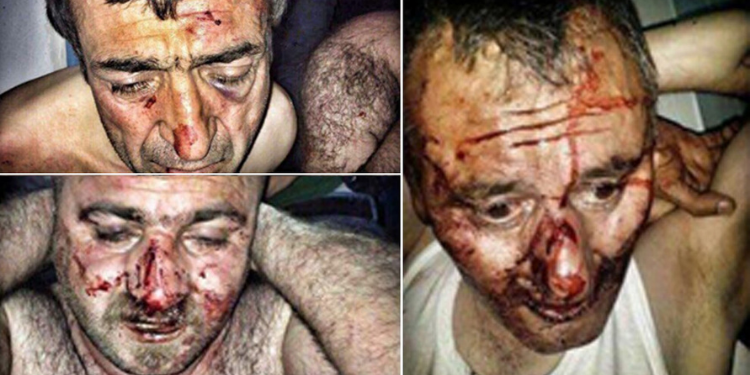 İşkence’nin Wan Valisi’ne göre adı: Basit yaralama