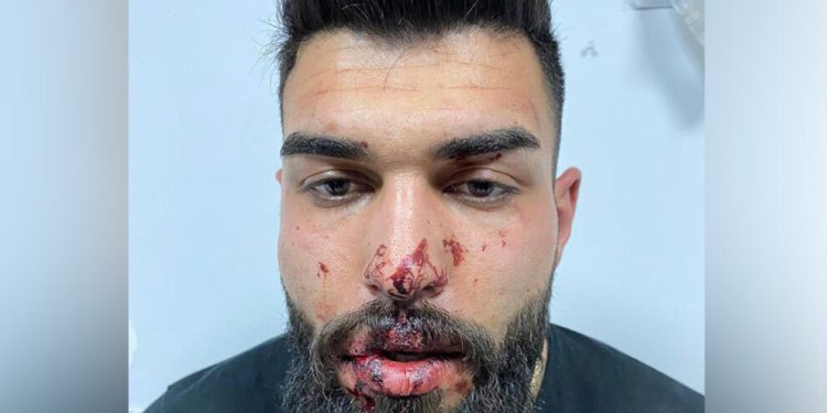 Faşist polis bir gence daha işkence yaptı