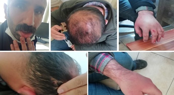 İran sınırından geçmeye çalışan iki kişiye çıplak işkence