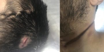 Cezaevinde katledilen Sıddık Uğur’un vücudunda işkence izleri