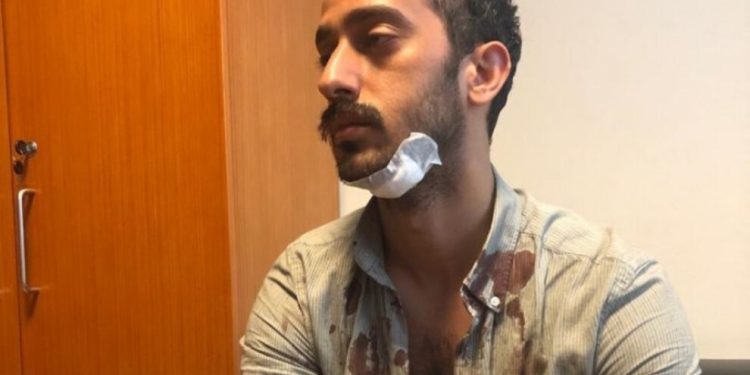 Kadıköy’de rehin alınanlara işkence yapıldı