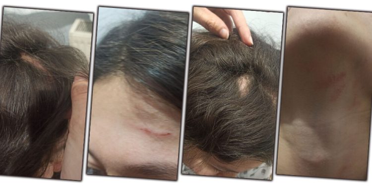 ÖGK üyesi Polat’a faşist polis Zengin’den işkence