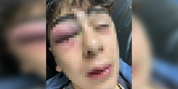 İşkenceye cezasızlık sürüyor: Polise sadece kınama cezası