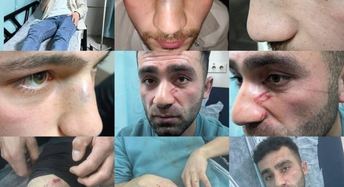 Colemêrg’te polis şiddeti: Darp raporu alan gençler gözaltında